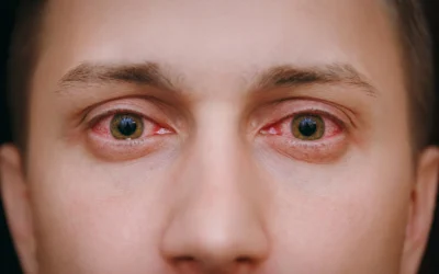 Pink Eye: Symptoms, Causes & Treatment
