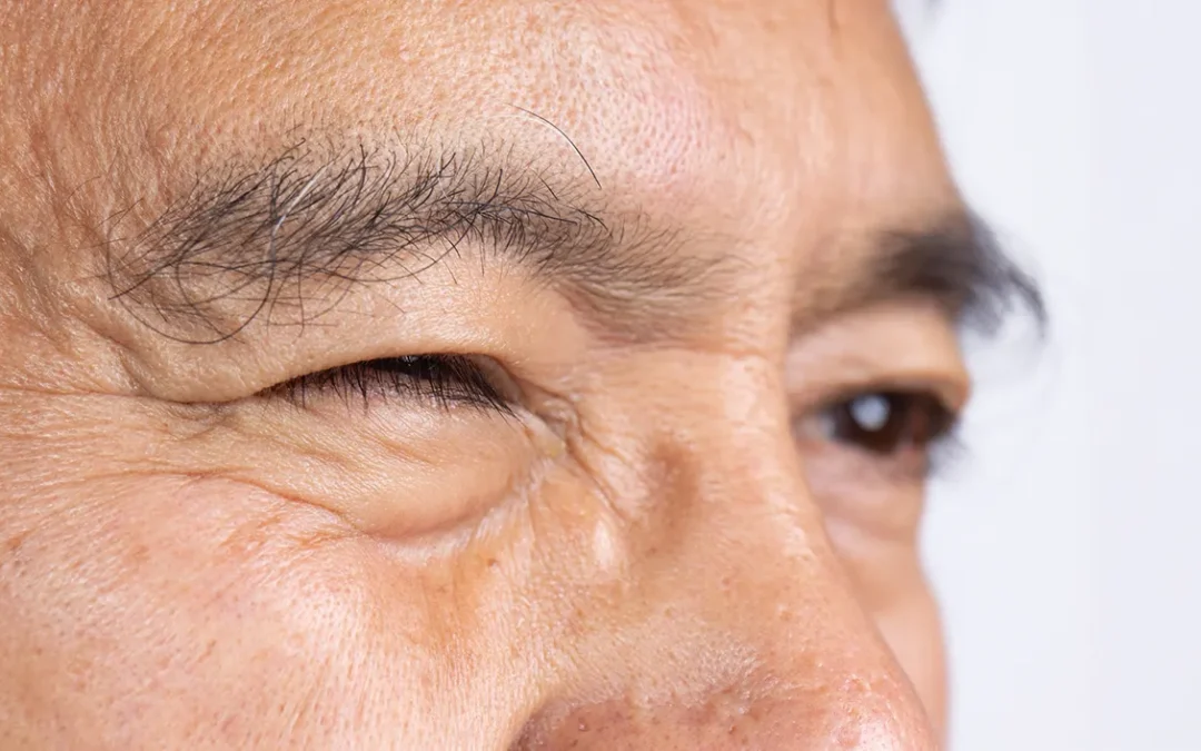 Eye Twitching: Why It Happens and When to See a Doctor
