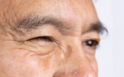 Eye Twitching: Why It Happens and When to See a Doctor